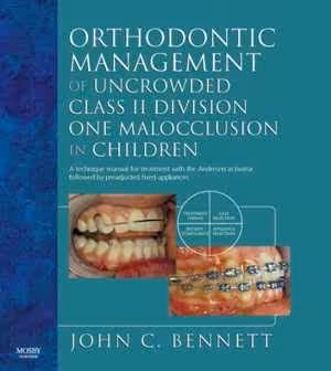 [PDF] دانلود کتاب Orthodontic Management Of Uncrowded Class II Division One Malocclusion In Children, 2006
