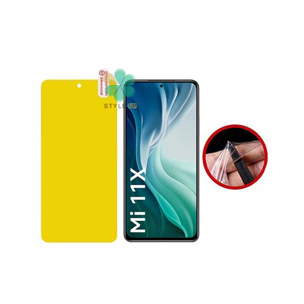 محافظ صفحه نانو گوشی شیائومی Xiaomi Mi 11X