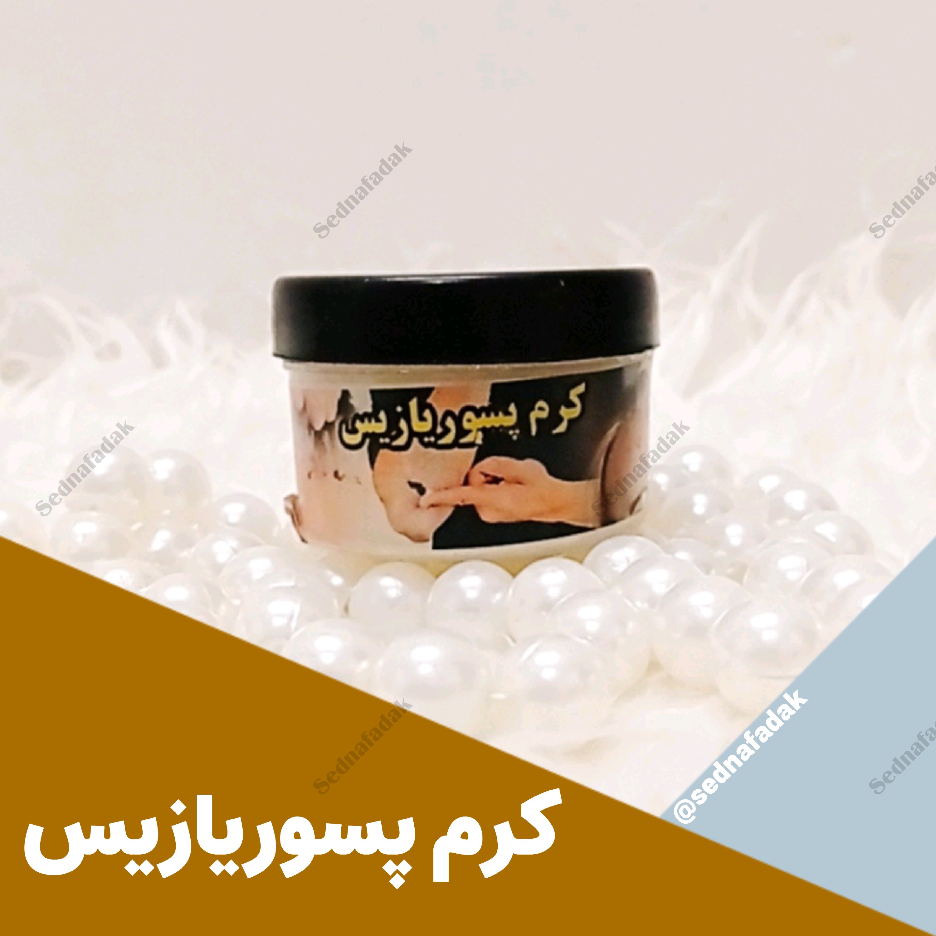 کرم پسوریازیس