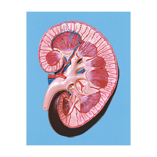 مولاژ کلیه دیواری