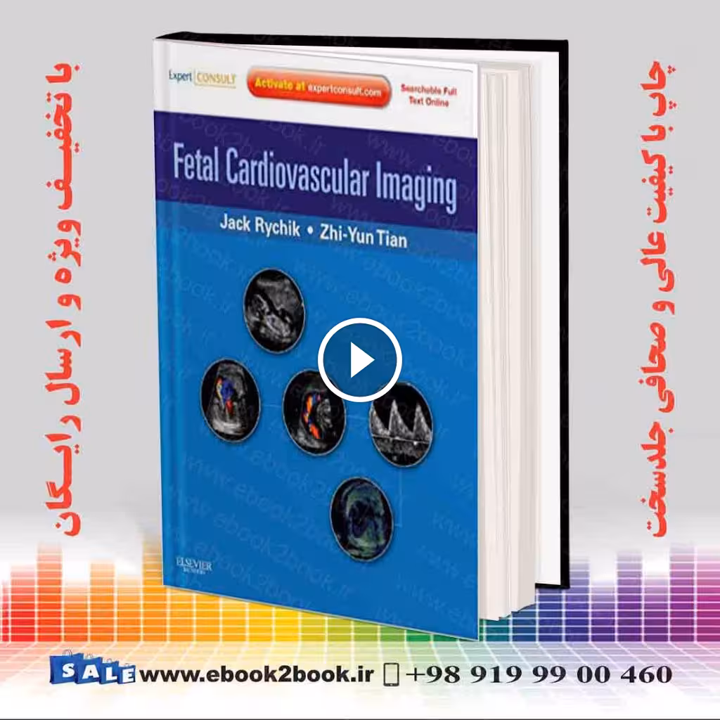 Fetal Cardiovascular Imaging
