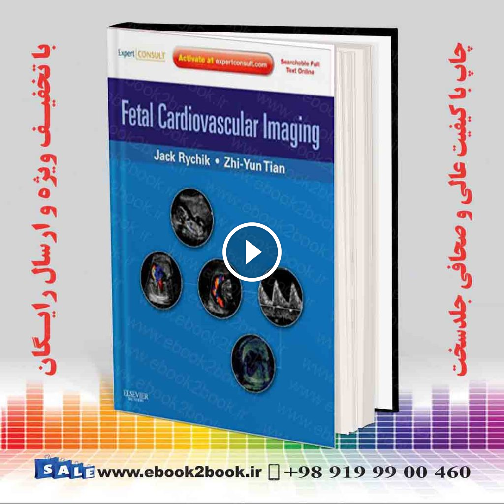 Fetal Cardiovascular Imaging
