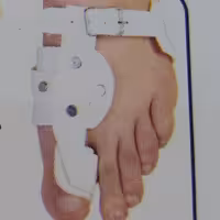 مجموعه اسپلینت هالوکس والگوس مدل طب و صنعت کد 10100 