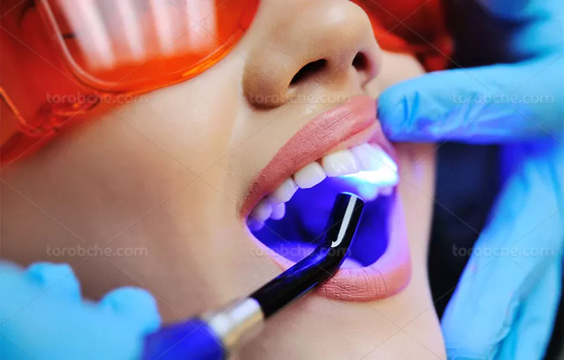 عکس دندان پزشکی | گرافیک با طعم تربچه