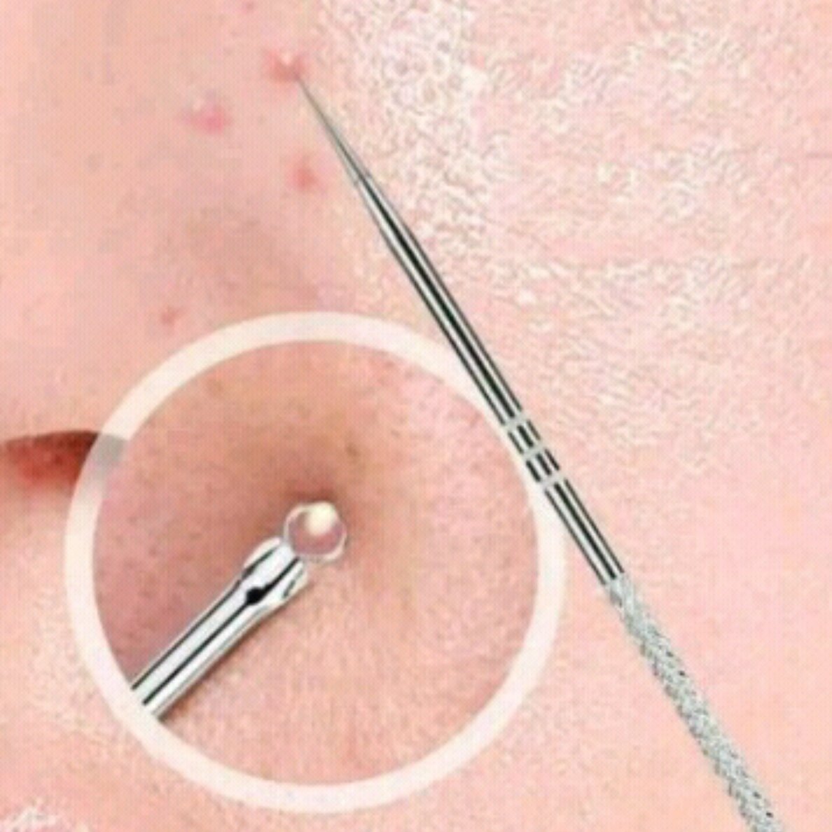 قلاب پاکسازی جوش صورت لانبنا
