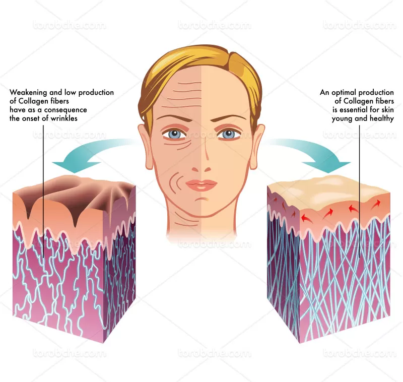وکتور مقایسه پوست سالم و چروکیده | گرافیک با طعم تربچه