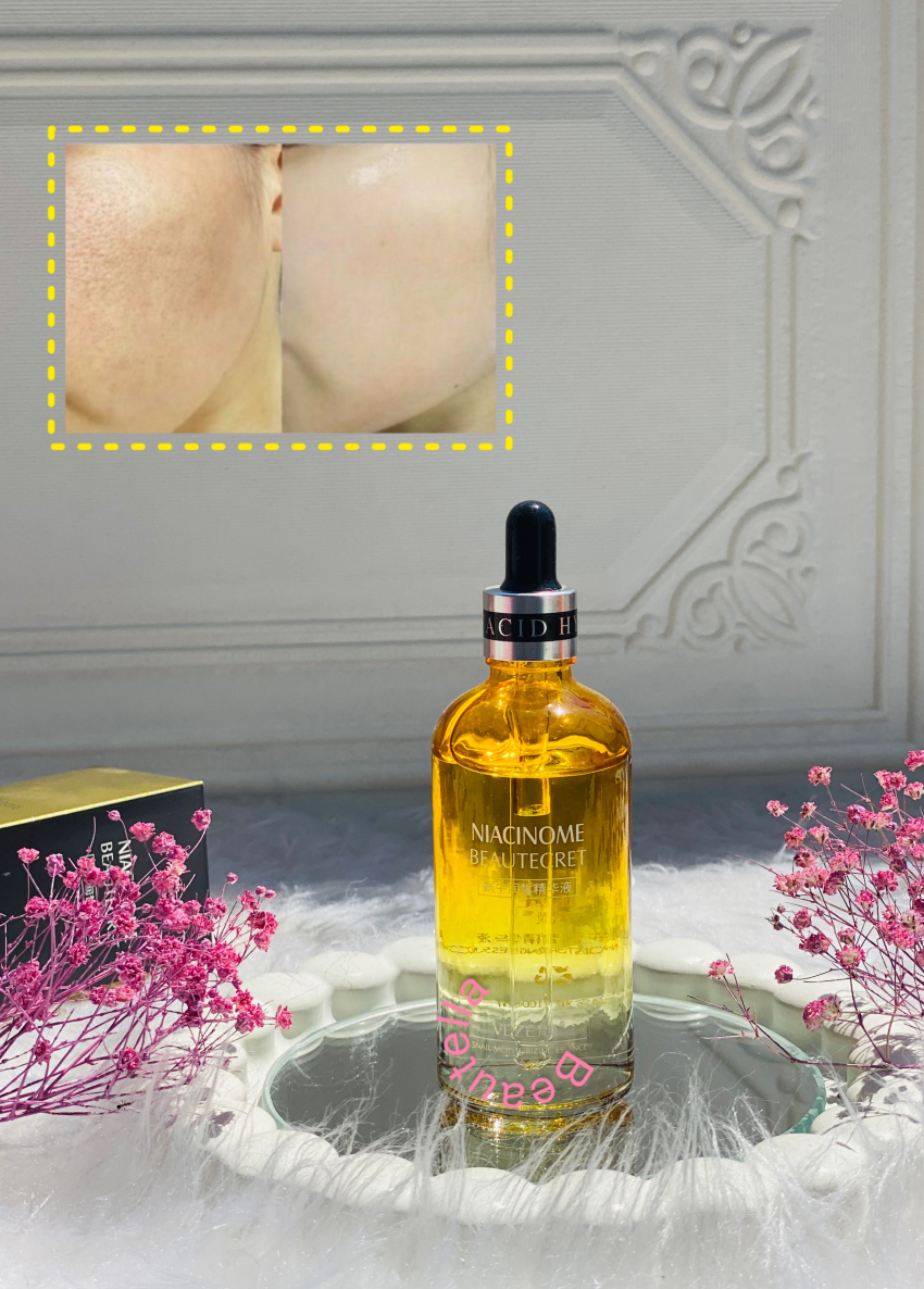 سرم جوانساز ولیفت کننده حلزون ونزن veze | بیوتلا