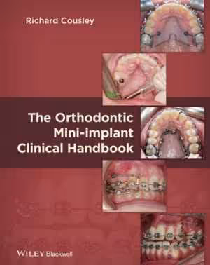 [PDF] دانلود کتاب The Orthodontic Mini-Implant Clinical Handbook, 2013