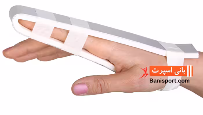آتل آلومینیومی انگشت 1 میل طب و صنعت 30100S