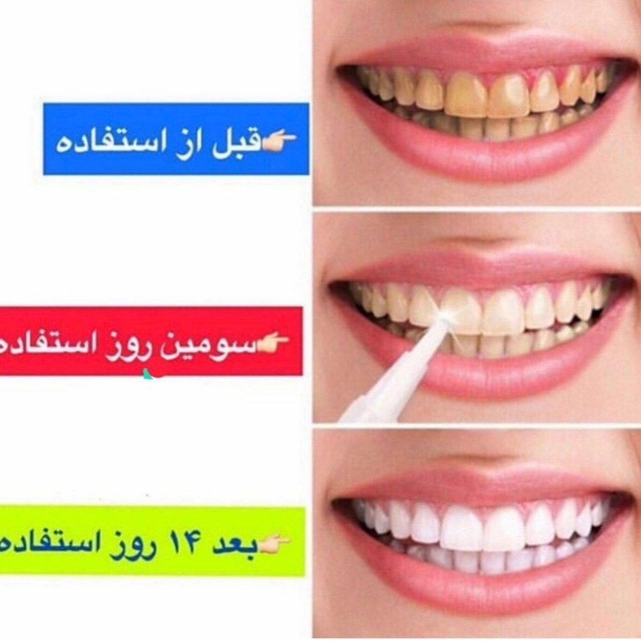 قلم سفید کننده دندان وایت دازلینگ اصل امریکایی