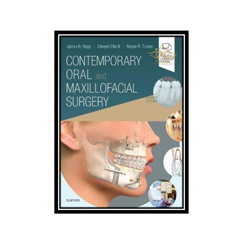 کتاب Contemporary Oral and Maxillofacial Surgery