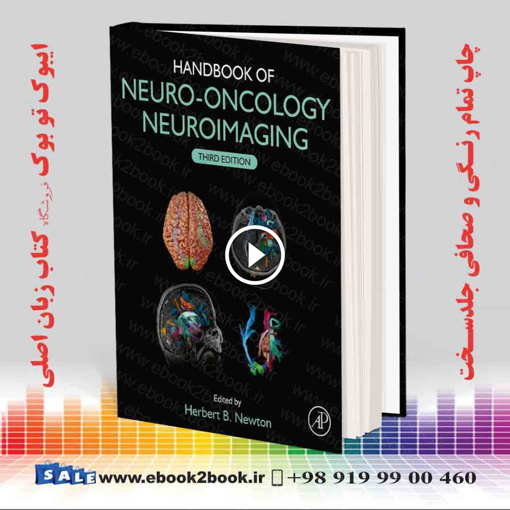 Handbook of Neuro-Oncology Neuroimaging 3rd Edition
