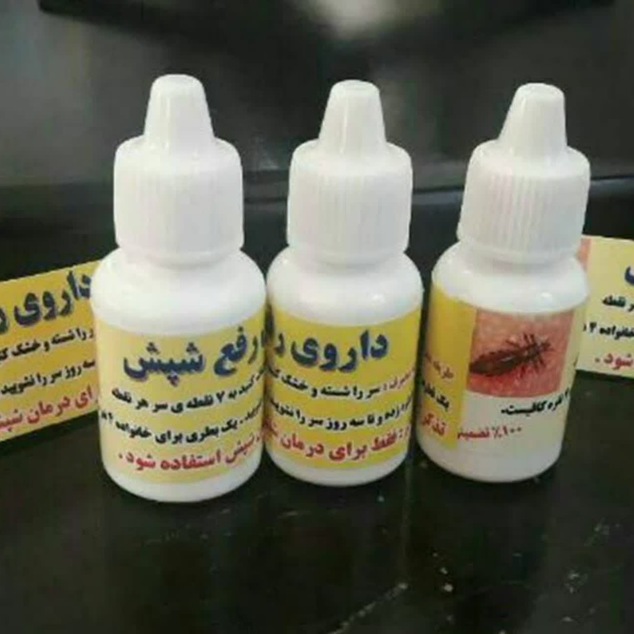 محلول ضد شپش