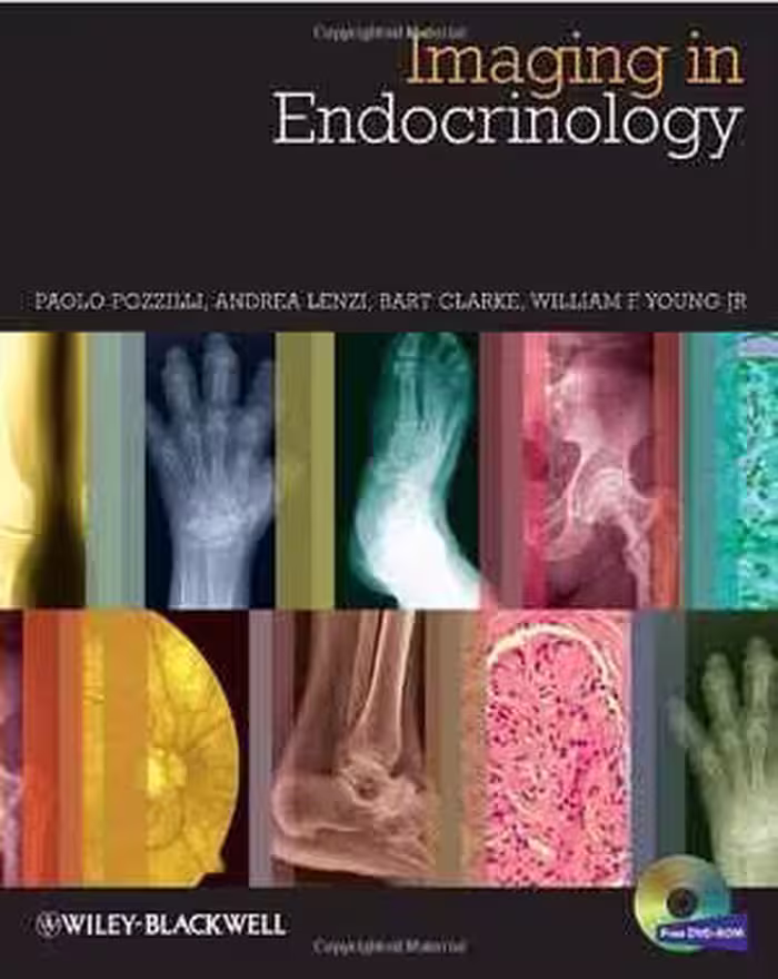 [PDF] دانلود کتاب Imaging In Endocrinology, 2014