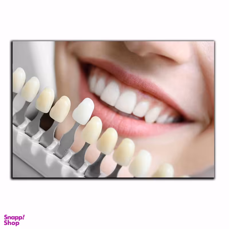 تابلو شاسی بکلیت طرح اصلاح لبخند و دندانپزشکی مدل SH-2032