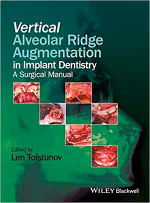 [PDF] دانلود کتاب Vertical Alveolar Ridge Augmentation In Implant Dentistry - A Surgical Manual, 2016