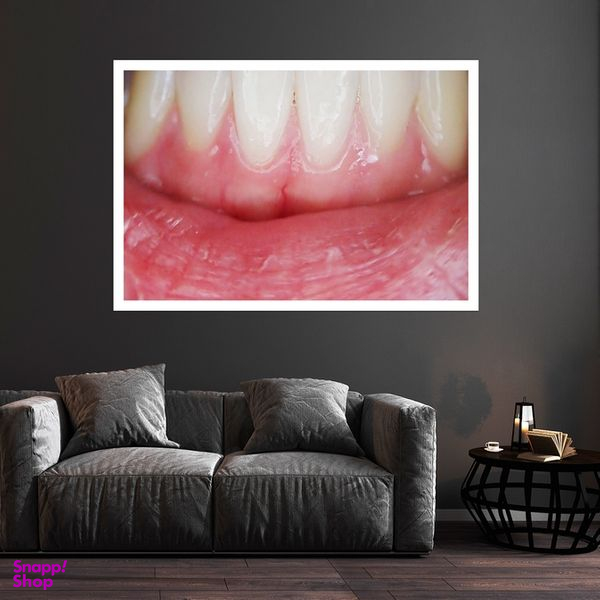 تابلو بکلیت طرح بهداشت دهان و دندان مدل قاب شاسی W-s9457