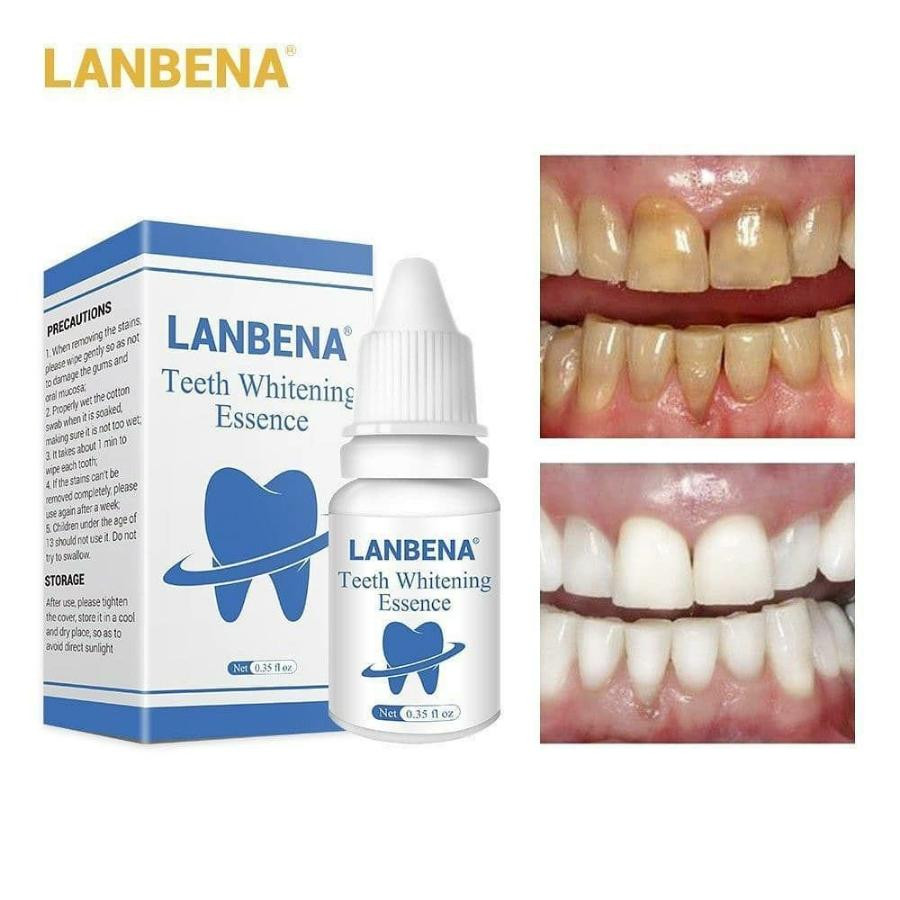 قطره سفید کننده دندان مدل LANBENA