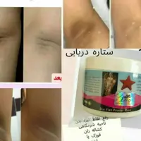 ماسک ستاره دریایی آنیا(اصل)