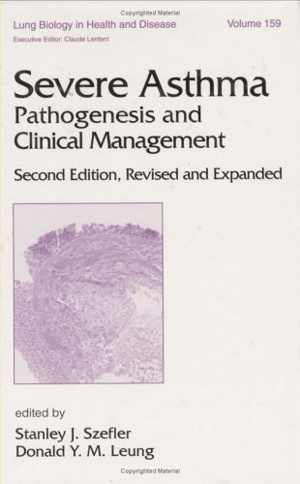 [PDF] دانلود کتاب Severe Asthma - Pathogenesis And Clinical Management, 2nd ed, 2001
