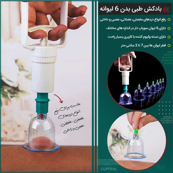 بادکش طبی بدن 6 لیوانه کد 1594