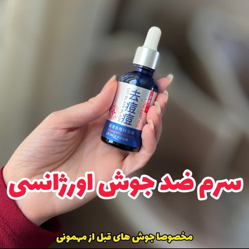 سرم ضدجوش اورژانسی