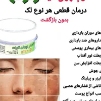 کرم رفع لک های عمیق بارداری وملاسما و آفتابسوختگی ،روشن کننده و رفع کک وومک