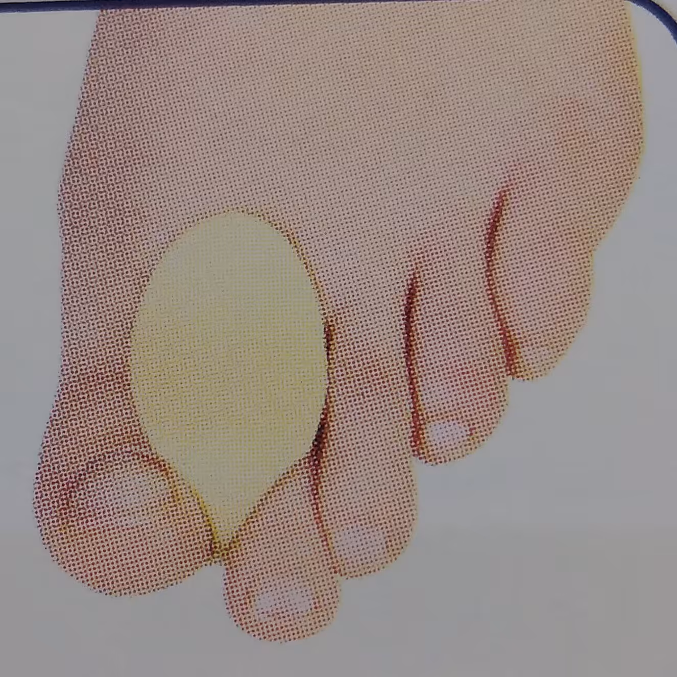 لا انگشتی طبی مدل طب و صنعت کد 10300 یک جفت در سایز  s  و L