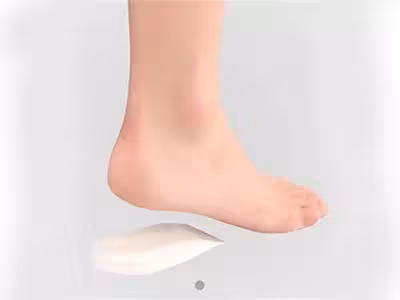 پد خار پاشنه طبی مدل 033 پاک سمن با تخفیف ویژه