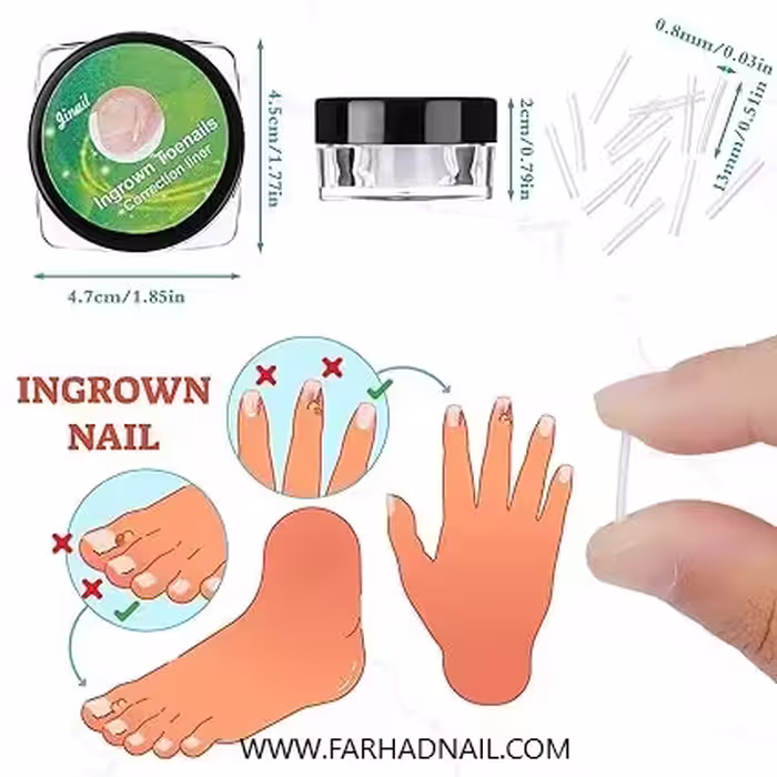 نوار اصلاح کننده ناخن فرورفته