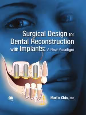 [PDF] دانلود کتاب Surgical Design For Dental Reconstruction With Implants - A New Paradigm, 2016