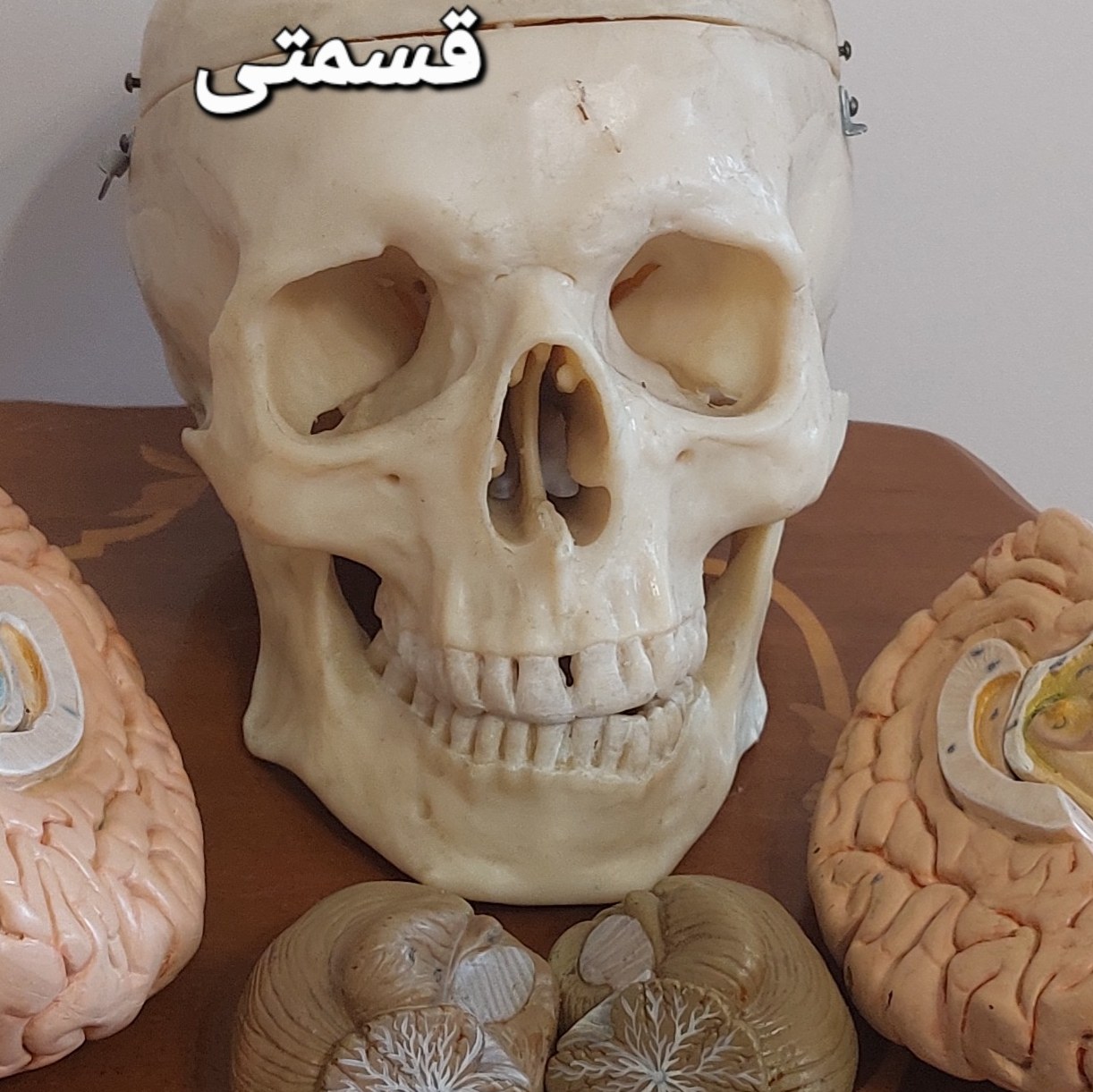 مولاژجمجمه و مغز 6 قسمتی
