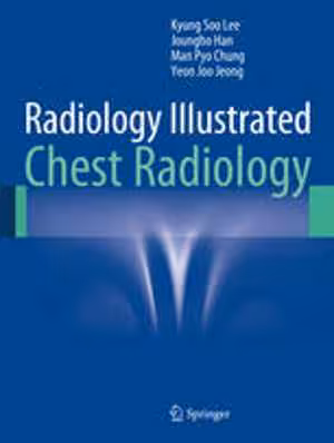 [PDF] دانلود کتاب Radiology Illustrated - Chest Radiology, 2014