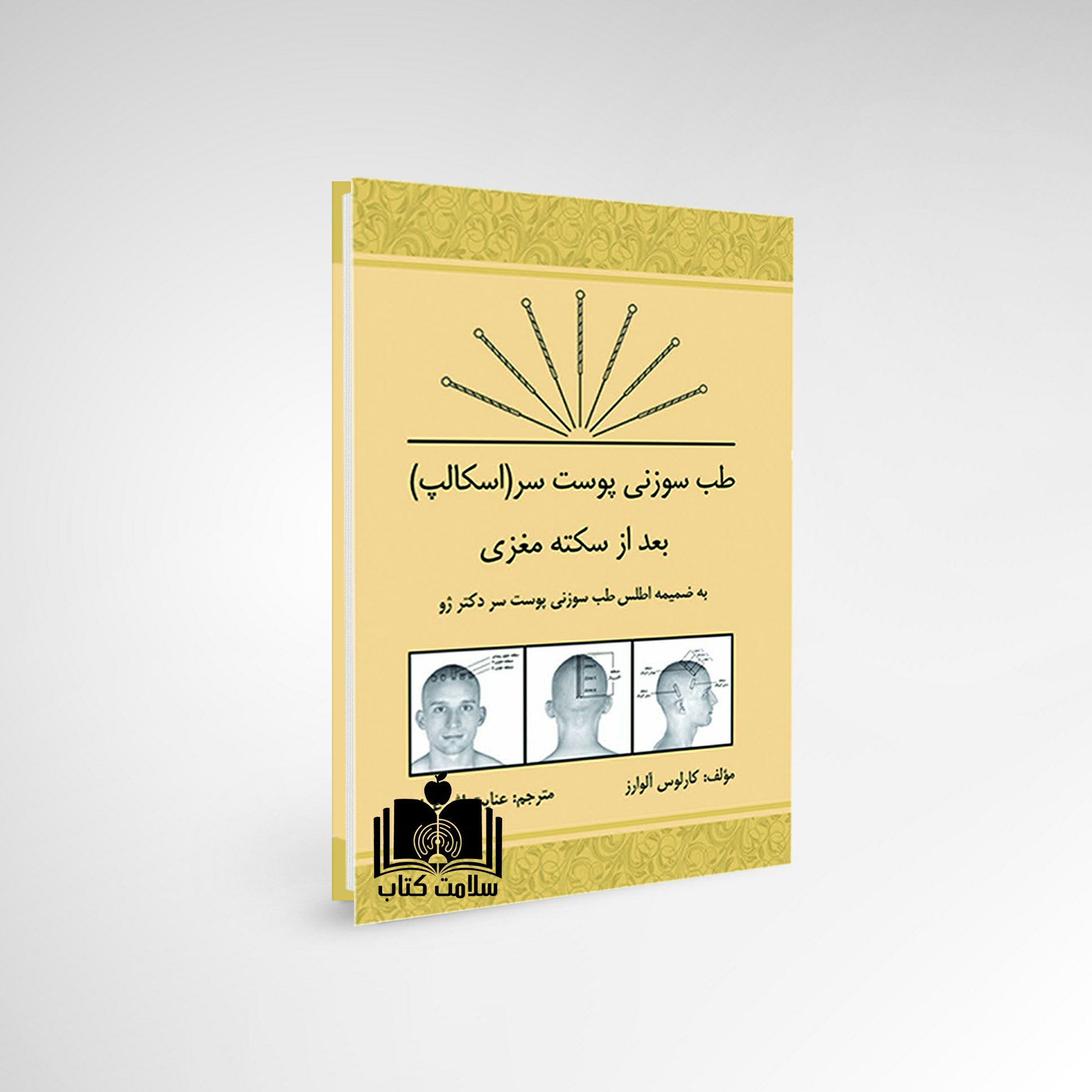 کتاب طب سوزنی پوست سر (اسکالپ) بعد از سکته مغزی