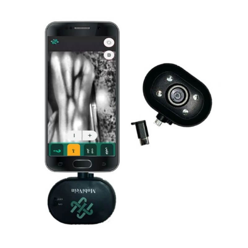 دستگاه رگیاب موبی وین Mobivein