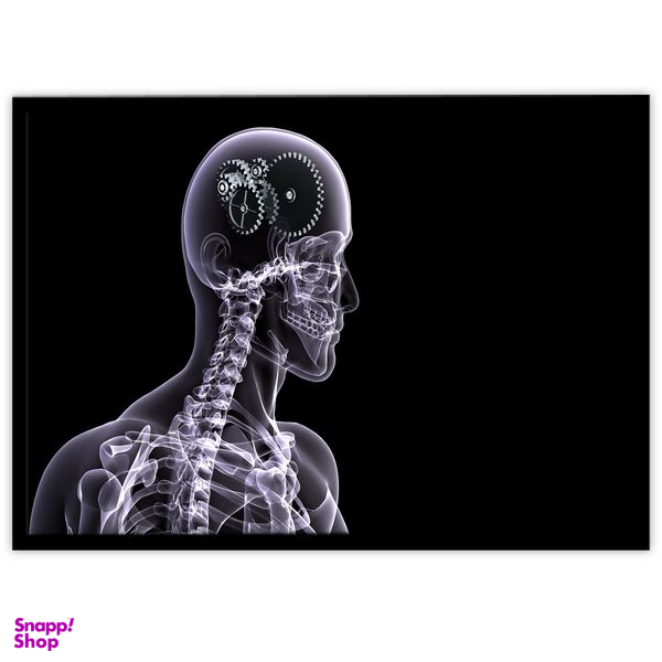 تابلو بکلیت طرح رادیوگرافی نخاع مدل B-10616