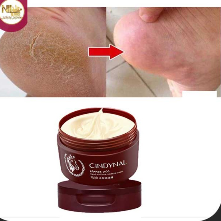 کرم ترک پا و دست روغن اسب سیندینال (از بین برنده ترکهای پوستی دست و پاشنه پا) (آرایشی شین بیوتی)